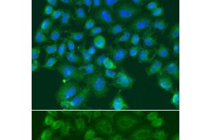 Immunofluorescence analysis of A549 cells using CST1 Polyclonal Antibody (CST1 antibody)