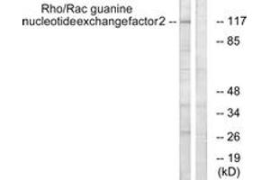 Western blot analysis of extracts from NIH-3T3 cells, using Rho/Rac Guanine Nucleotide Exchange Factor 2 (Ab-885) Antibody. (ARHGEF2 antibody  (AA 851-900))