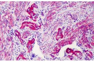 Human Uterus: Formalin-Fixed, Paraffin-Embedded (FFPE) (SLC5A3 antibody  (AA 221-270))