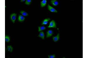 Immunofluorescence staining of A549 cells with ABIN7158492 at 1:100, counter-stained with DAPI. (SLC27A1 antibody  (AA 453-570))