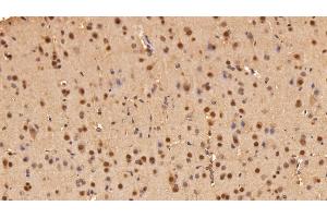 Detection of ADRM1 in Rat Cerebrum Tissue using Polyclonal Antibody to Adhesion Regulating Molecule 1 (ADRM1) (ADRM1 antibody  (AA 2-407))