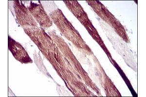 Immunohistochemical analysis of paraffin-embedded muscle tissues using VIL1 mouse mAb with DAB staining. (Villin 1 antibody  (AA 1-209))