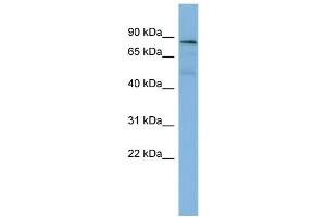 WB Suggested Anti-PTPN12  Antibody Titration: 0. (PTPN12 antibody  (Middle Region))