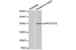 Western blot analysis of extract from 293 cells, using phospho-IRS1-S312 antibody (ABIN2987536). (IRS1 antibody  (pSer312))