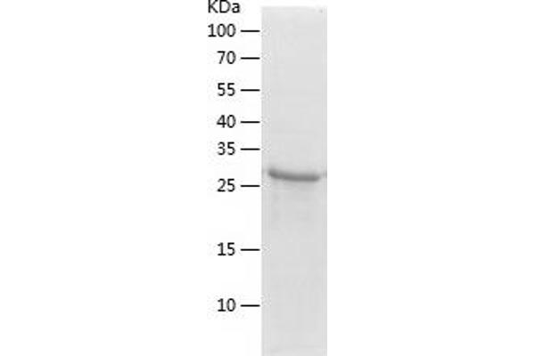 ZNF8 Protein (AA 239-520) (His tag)