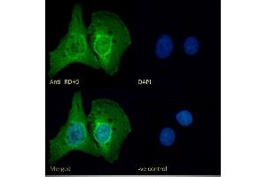 (ABIN571175) Immunofluorescence analysis of paraformaldehyde fixed U2OS cells, permeabilized with 0. (RDH5 antibody  (AA 19-31))