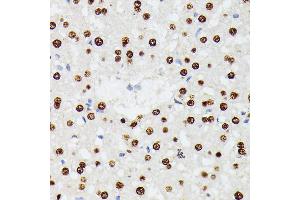 Immunohistochemistry of paraffin-embedded rat liver using HNRNPD antibody (ABIN7267632) at dilution of 1:100 (40x lens). (HNRNPD/AUF1 antibody  (AA 1-306))