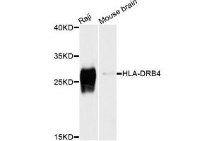 Western blot analysis of extracts of Raji and mouse brain cells, using HLA-DRB4 antibody.