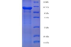 SDS-PAGE (SDS) image for PLY1 (AA 22-354) protein (His-SUMO Tag) (ABIN5711707) (PLY1 (AA 22-354) protein (His-SUMO Tag))