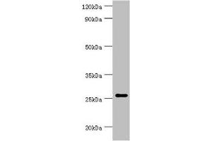 Western blot All lanes: Tumor necrosis factor ligand superfamily member 13 antibody at 10 μg/mL + Hela whole cell lysate Secondary Goat polyclonal to rabbit IgG at 1/10000 dilution Predicted band size: 28, 26, 25, 37, 23 kDa Observed band size: 28 kDa (TNFSF13 antibody  (AA 105-247))