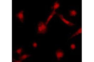 Immunofluorescent analysis of GRK2 staining in HeLa cells. (GRK2 antibody  (C-Term))