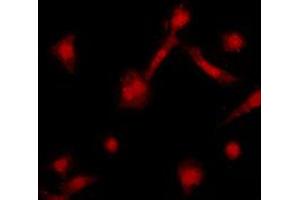 Immunofluorescent analysis of GRK2 staining in HeLa cells. (GRK2 antibody  (C-Term))