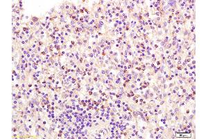 Formalin-fixed and paraffin embedded human spleen labeled with Anti ADCY6 Polyclonal Antibody, Unconjugated (ABIN751198) at 1:200 followed by conjugation to the secondary antibody and DAB staining (ADCY6 antibody  (AA 760-819))