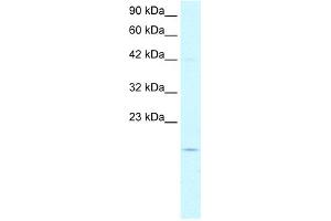 WB Suggested Anti-PFDN1 Antibody Titration:  5. (PFDN1 antibody  (N-Term))