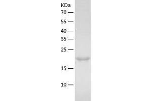 desert Hedgehog Protein (AA 24-198) (His tag)