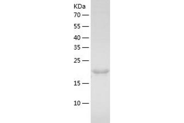 desert Hedgehog Protein (AA 24-198) (His tag)