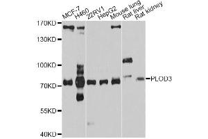 Western blot analysis of extracts of various cell lines, using PLOD3 antibody (ABIN4904792) at 1:1000 dilution.
