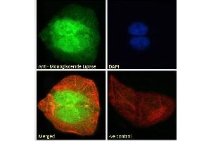 ABIN334436 Immunofluorescence analysis of paraformaldehyde fixed U2OS cells, permeabilized with 0. (MGLL antibody  (Internal Region))