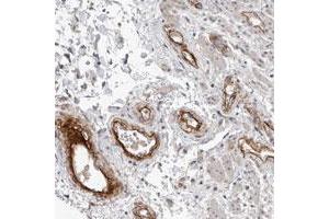 Immunohistochemical staining of human rectum with C1orf216 polyclonal antibody  shows strong positivity in endothelial cells at 1:10-1:20 dilution. (C1ORF216 antibody)