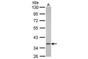 Image no. 1 for anti-Guanine Nucleotide Binding Protein (G Protein), alpha Transducing Activity Polypeptide 1 (GNAT1) (AA 37-350) antibody (ABIN1498484) (GNAT1 antibody  (AA 37-350))
