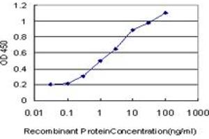 Detection limit for recombinant GST tagged ERCC1 is approximately 0. (ERCC1 antibody  (AA 207-281))