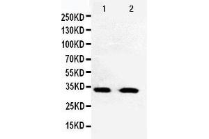 Anti-Cdk5 antibody, Western blotting Lane 1: HELA Cell Lysate Lane 2: JURKAT Cell Lysate