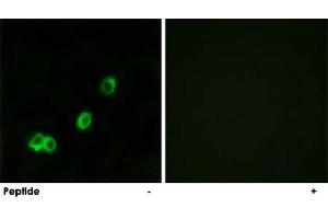 Immunofluorescence analysis of MCF-7 cells, using ACOT1 polyclonal antibody . (ACOT1 antibody)