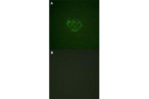 Immunofluorescence staining of methanol-fixed A-549 cells with TNK2 (phospho Y284) polyclonal antibody  without blocking peptide (A) or preincubated with blocking peptide (B) at 1:100-1:200 dilution. (TNK2 antibody  (pTyr284))