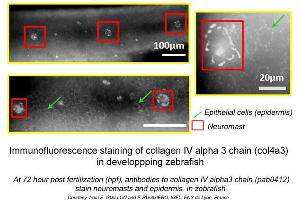 Image no. 1 for anti-Collagen, Type IV, alpha 3 (COL4A3) (C-Term) antibody (ABIN347487) (COL4a3 antibody  (C-Term))