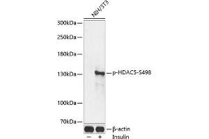 Western blot analysis of extracts of NIH/3T3 cells, using Phospho-HD-S498 antibody (ABIN3019793, ABIN3019794, ABIN3019795 and ABIN1681641) at 1:2000 dilution. (HDAC5 antibody  (pSer498))