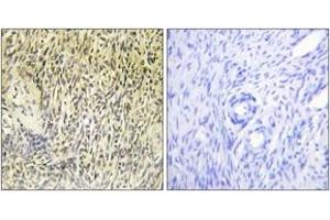 Immunohistochemistry (IHC) image for anti-Spleen tyrosine Kinase (SYK) (AA 289-338) antibody (ABIN2888703) (SYK antibody  (AA 289-338))