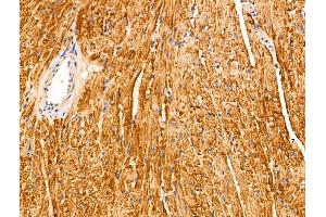 ABIN6265607 and ABIN6266680 at 1/100 staining Mouse heart tissue by IHC-P. (ANO9 antibody  (Internal Region))