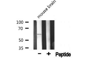 Western blot analysis of Phospho-AKT1(Thr308) expression in Mouse brain lysate (AKT1 antibody  (pThr308))