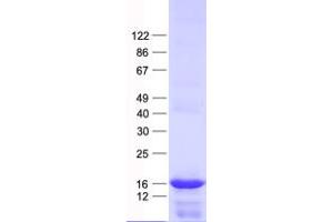 Validation with Western Blot (PRELID2 Protein (His tag))