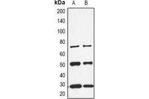 Western Blotting (WB) image for anti-Calbindin (CALB1) (C-Term) antibody (ABIN7304264)
