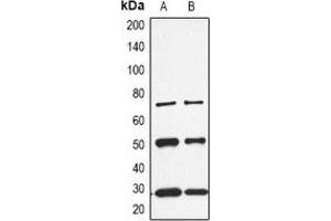 Western blot analysis of CALB1 expression in K562 (A), rat kidney (B) whole cell lysates. (CALB1 antibody  (C-Term))