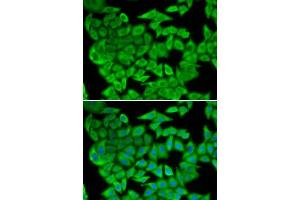 Immunofluorescence analysis of U2OS cells using MDH2 antibody.