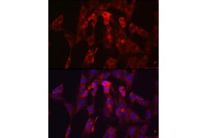 Immunofluorescence analysis of C6 cells using TIMP2 Rabbit pAb (ABIN3022132, ABIN3022133, ABIN1513608, ABIN1514751 and ABIN6218618) at dilution of 1:250 (40x lens). (TIMP2 antibody  (AA 100-200))