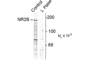 Image no. 1 for anti-Glutamate Receptor, Ionotropic, N-Methyl D-Aspartate 2B (GRIN2B) (pTyr1252) antibody (ABIN372685) (GRIN2B antibody  (pTyr1252))