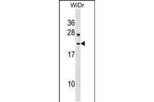 Western blot analysis in WiDr cell line lysates (35ug/lane). (LYZL6 antibody  (AA 37-65))