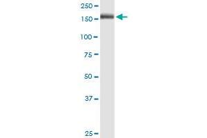 MRC1 monoclonal antibody (M02), clone 5C11. (Macrophage Mannose Receptor 1 antibody  (AA 22-130))