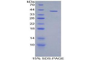 SDS-PAGE (SDS) image for Chemokine (C-C Motif) Ligand 20 (CCL20) (AA 24-95) protein (His tag,GST tag) (ABIN2123233)