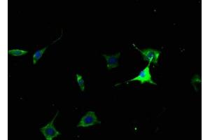 Immunofluorescence staining of SH-SY5Y cells with ABIN7139924 at 1:50, counter-stained with DAPI. (Muscarinic Acetylcholine Receptor M2 antibody  (AA 3-20))