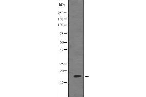 Western blot analysis of HES5 expression in 293 cell lysate ,The lane on the left is treated with the antigen-specific peptide.