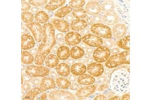Immunohistochemistry of paraffin embedded mouse kidney using collagen alpha-1 (V) (ABIN7073547) at dilution of 1: 1800 (400x lens) (Collagen Type V antibody)