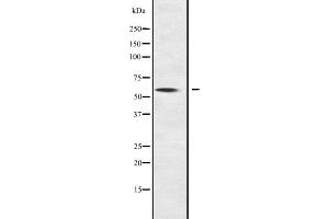 Western blot analysis of NOC4L expression in NOC4L transfected 293T cell lysate;,The lane on the left is treated with the antigen-specific peptide. (NOC4L antibody  (Internal Region))