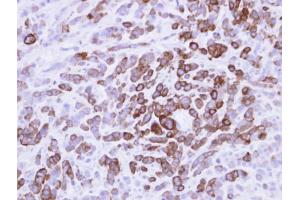 IHC-P Image MX1 Antobody detects MX1 protein at cytosol on MDA-MB-468 xenograft by immunohistochemical analysis. (MX1 antibody  (Center))