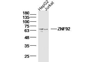 Lane 1: Hepg2 lysates Lane 2: Jurkat lysates probed with ZNF92 Polyclonal Antibody, Unconjugated  at 1:300 dilution and 4˚C overnight incubation. (ZNF92 antibody  (AA 21-120))