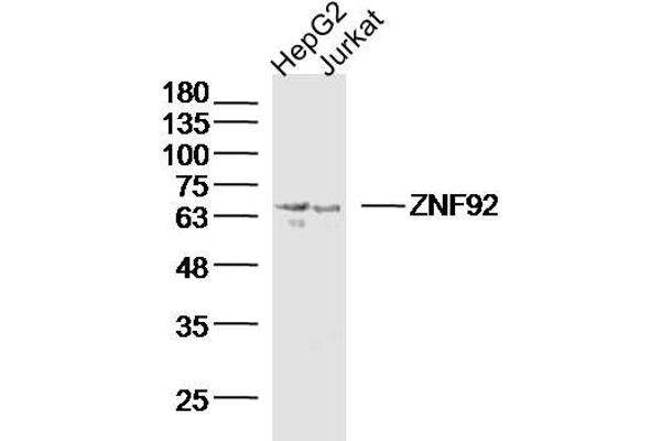 ZNF92 Antikörper  (AA 21-120)