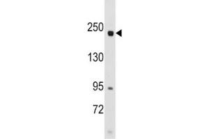 Western blot analysis of RICTOR antibody and SK-BR-3 lysate.